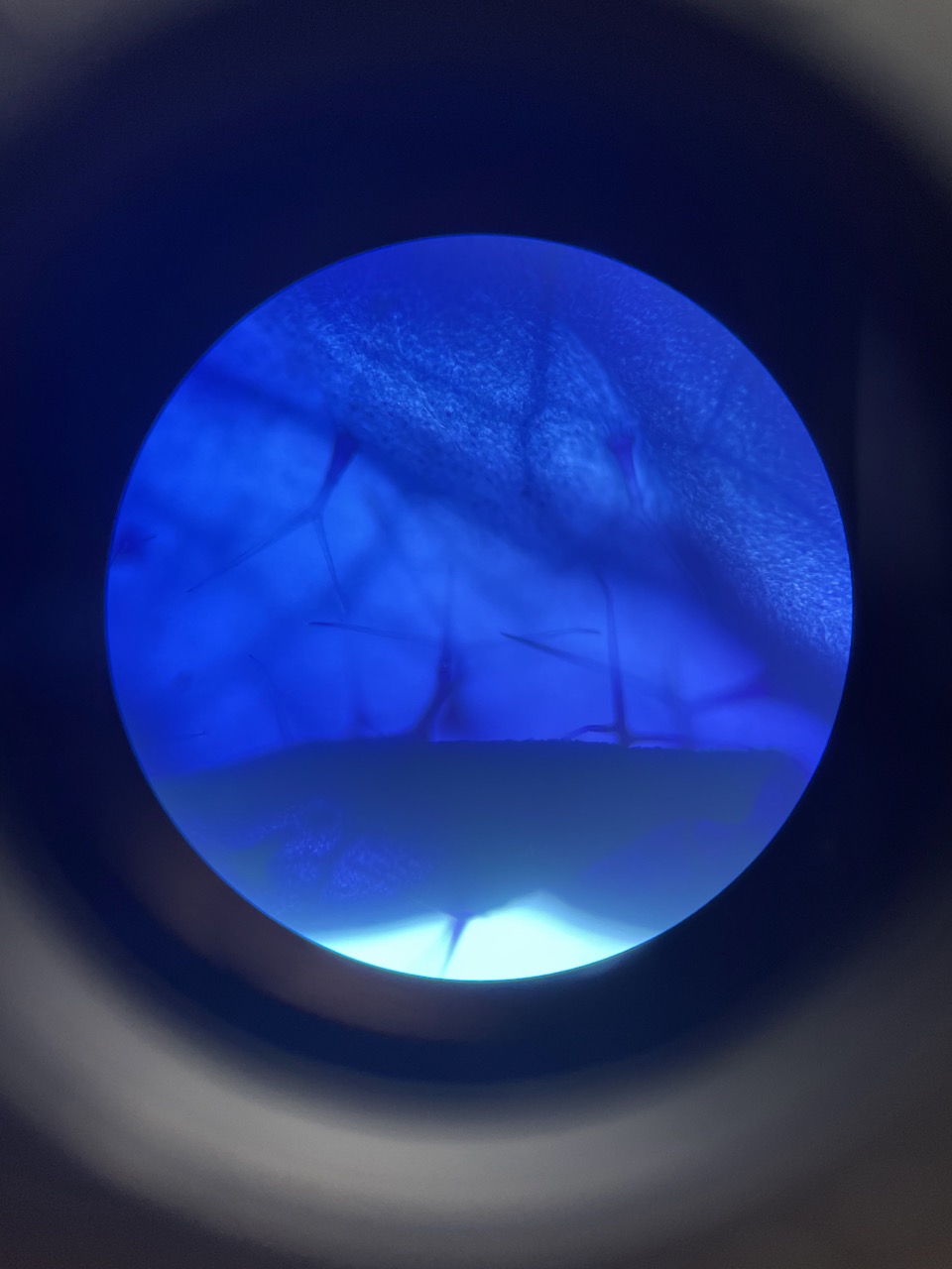an image from a microscope of many trichomes dyed blue for easier visibility.
