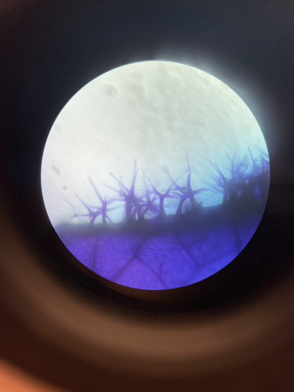 an image from a microscope of a trichome dyed blue.
