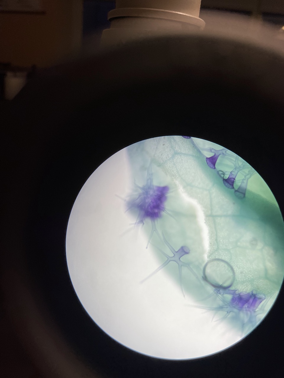 an image from a microscope of many trichomes dyed blue for easier visibility.