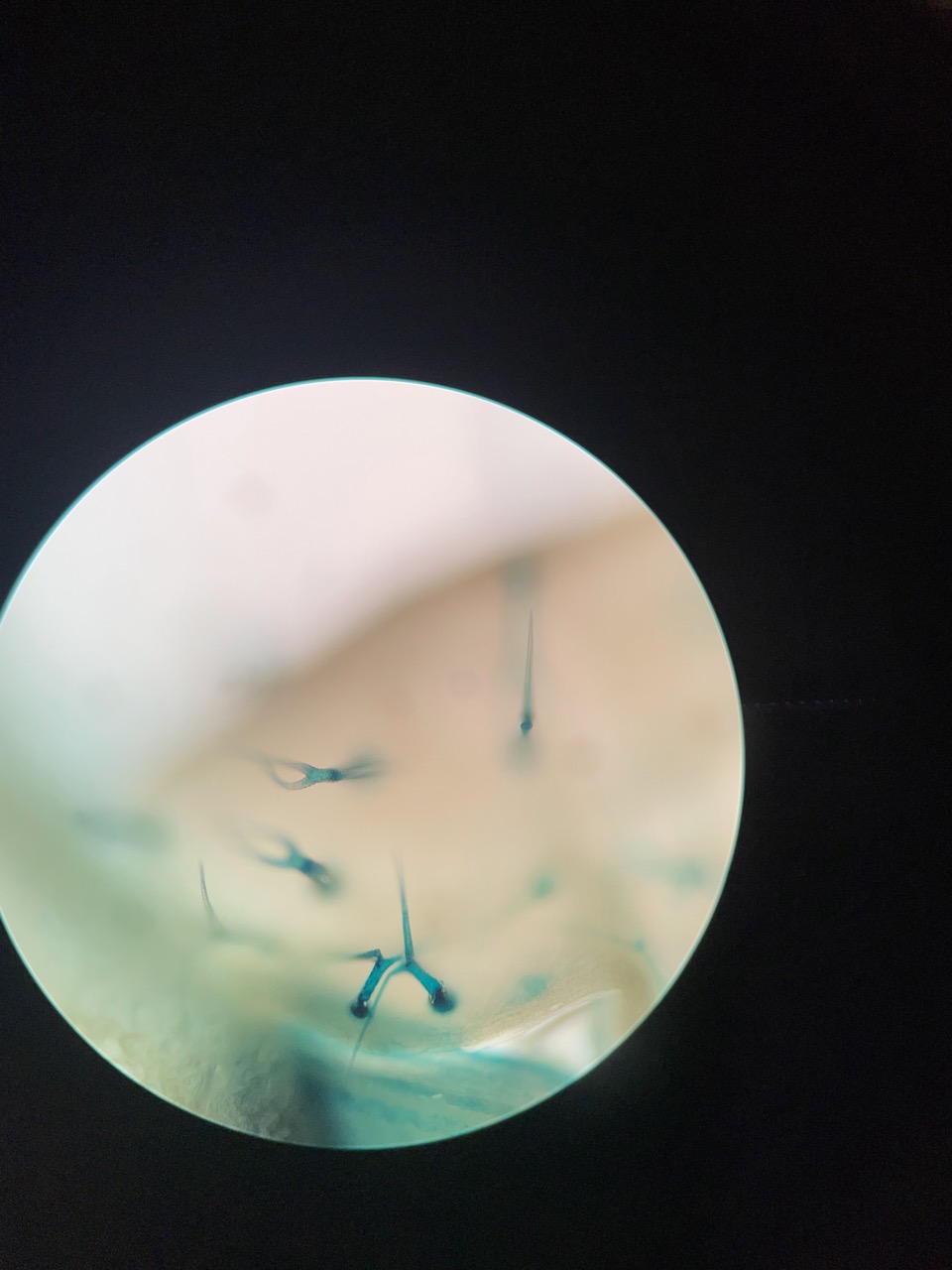 an image from a microscope of many trichomes dyed blue for easier visibility.
