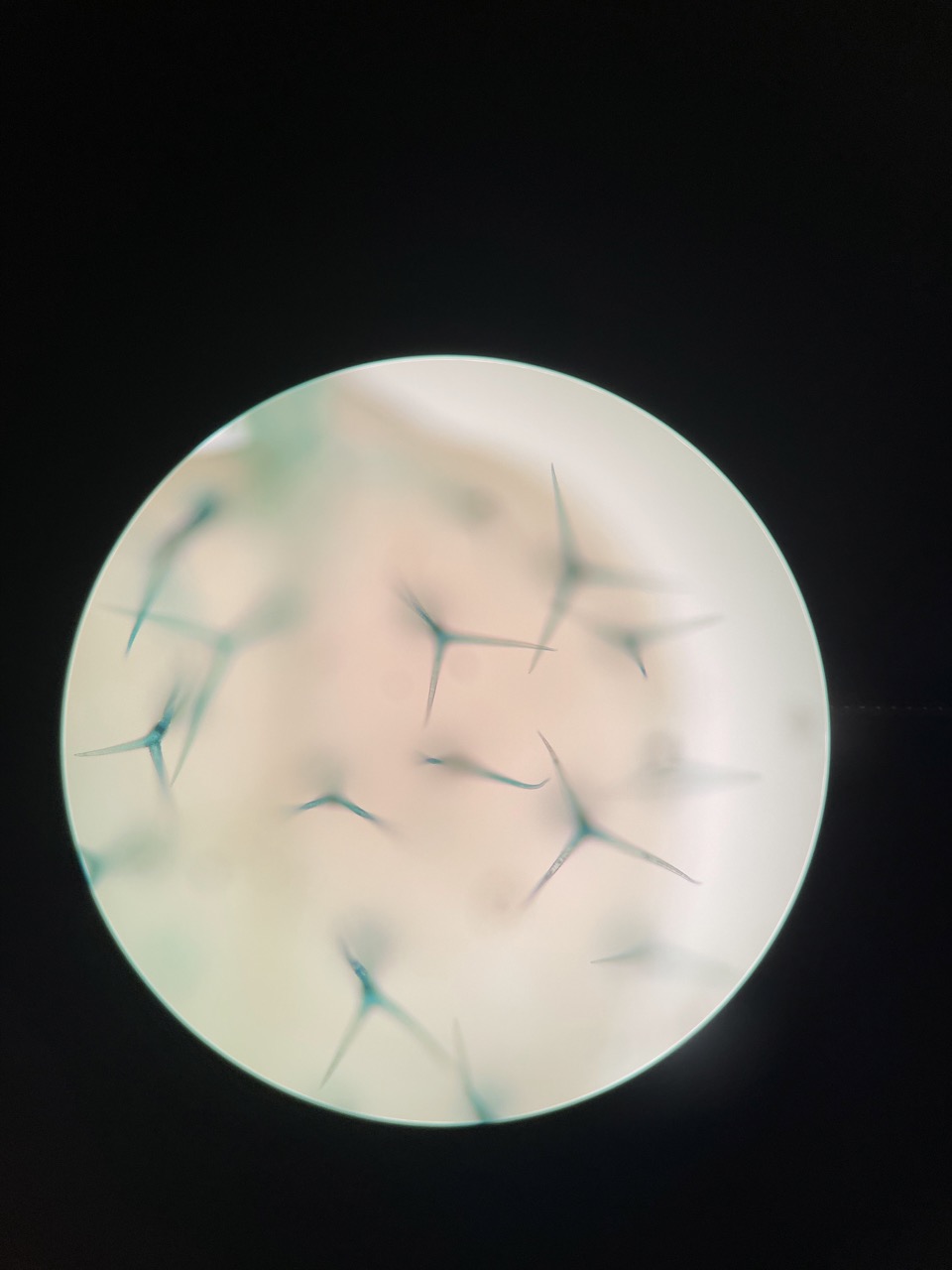 an image from a microscope of many trichomes dyed blue for easier visibility.